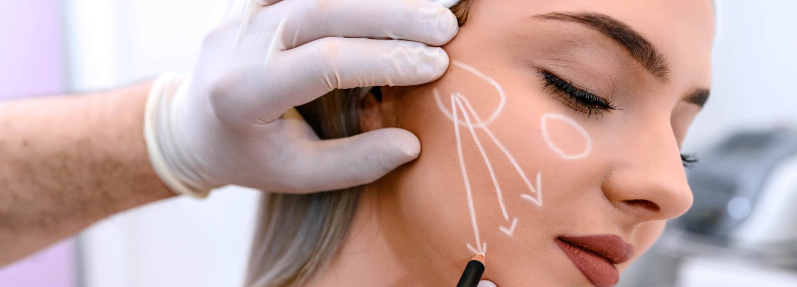 Lifting Cervico-Facial