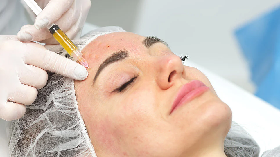 PRP Visage